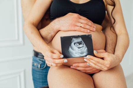 A happy married couple is holding in their hands a snapshot of an ultrasonic study of the baby....