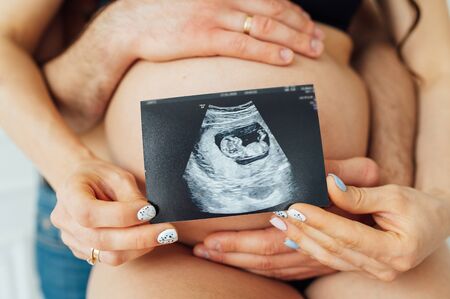 A happy married couple is holding in their hands a snapshot of an ultrasonic study of the baby. Husband hugs a beautiful adult pregnant wife. Second trimesterの写真素材