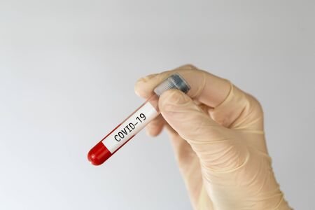 Laboratory sample of blood testing for diagnosis new Corona virus infection COVID-19の写真素材