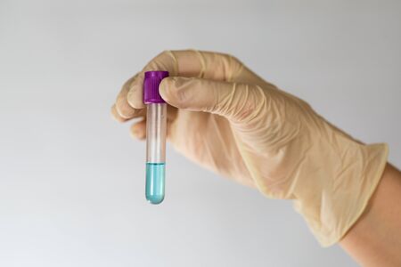 Test tube with blue transparent chemical fluid in the hands of a scientist. Hands in latex gloves....