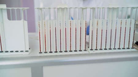 Coronavirus vaccine testing. Blood in test tubes. Science laboratory test tubes. Blood tubes to test...