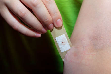 Blood stain on the bandage after injection . Woman arm , medical concept