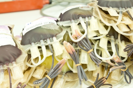 Details shot of platelet concentrate, Human blood in storageのeditorial素材