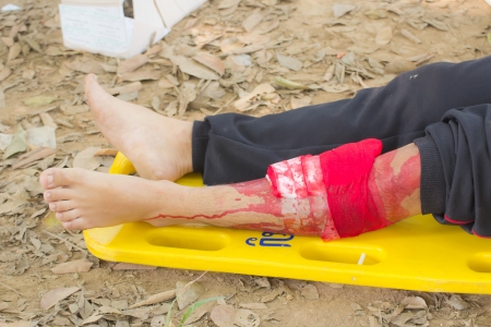 PHRAE,THAILAND - DECEMBER 20 : Unidentified  men are first aid training from staff  the hospital on  December 20, 2012 at local parks, Muang, Phrae, Thailand.のeditorial素材