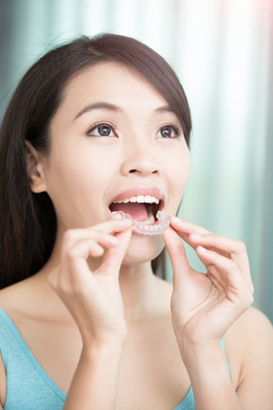 beauty woman smile happily with invisible bracesの写真素材