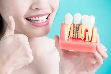 woman take tooth implant false tooth on green backgroundの写真素材