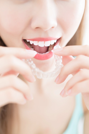 woman take invisible braces  and smile at homeの写真素材