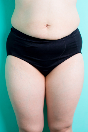 Fat overweight woman body with green backgroundの写真素材