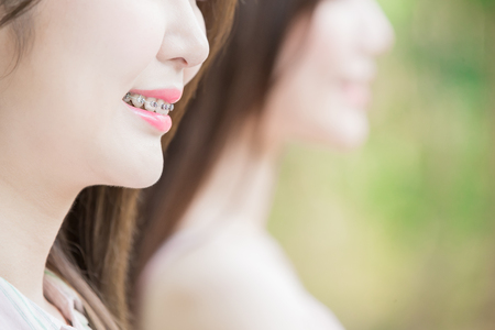 close up of woman tooth for your dental conceptの写真素材