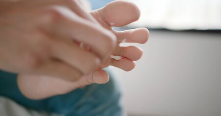 man applying cream for athletes foot treatment by cotton swabの写真素材
