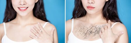 woman touch her chest with dry skin - moisturizing care conceptの写真素材