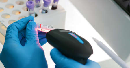 close up of microbiologist or medical worker scan blood test result as positive for the coronavirus covid-19の写真素材