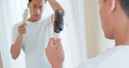 Asian man worry about his receding hairline and look in mirror with many hair on hairbrushの写真素材