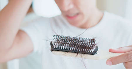 Asian man worry about his receding hairline and look hairbrush with many hair on itの写真素材