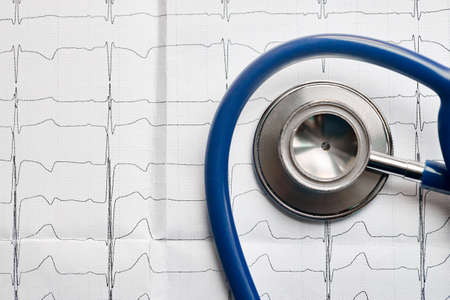 Medical concept. Cardiogram with stethoscope selective focus closeup top view background with copyspace.の写真素材