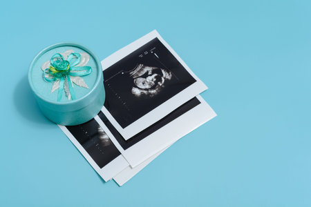 A gift and prints of sonogram.