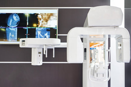 Dental 3D scanner for implant placementの写真素材