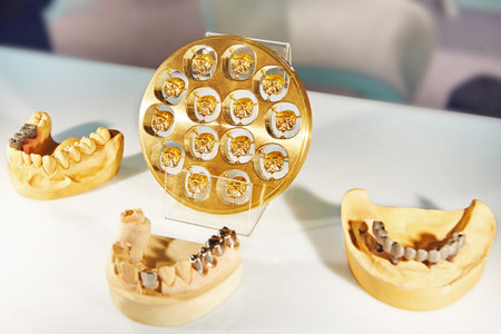 Dental crown placement equipmentの写真素材