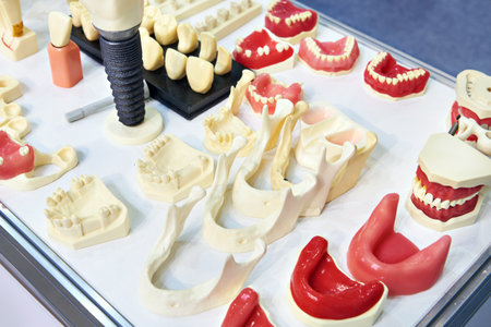 Molds, models and mock-ups of the teeth, jaws and bones of the human head for dentistryの写真素材