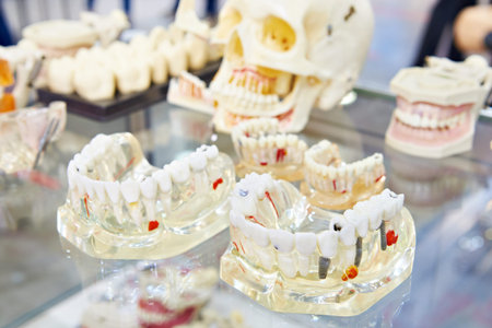Dentures teeth mockups in dental store exhibition