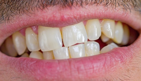 caucasian man teethの写真素材