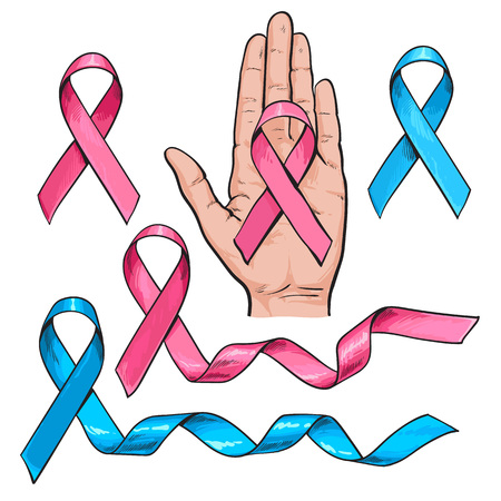 Pink and light blue ribbon set, symbol of breast, prostate, childhood cancer awareness, sketch vector illustration isolated on white background. Sketched set of pink and blue ribbons, cancer awarenessのイラスト素材
