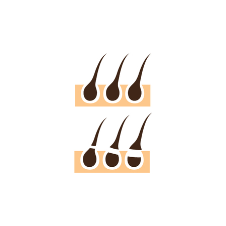 Diagram showing difference in methods of hair removal, flat style vector illustration isolated on white background. Side view diagram showing hairs removed by different methodsのイラスト素材