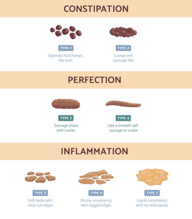 Bristol stool chart with medicine description of type human feces.のイラスト素材