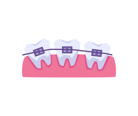 Uneven row of teeth with braces flat style, vector illustrationのイラスト素材