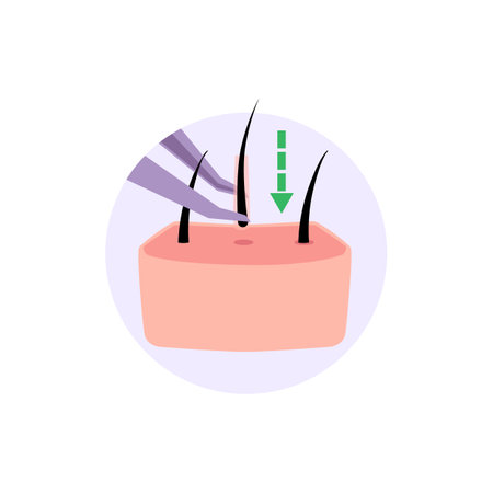 Hair transplantation, medical icon, vector illustration on whiteのイラスト素材