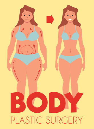 Plastic surgery design, woman losing weight, cartoon vector illustrationのイラスト素材