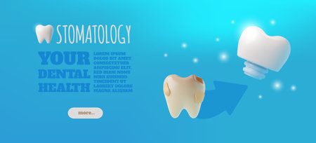 Your dental health advertising banner 3D vector design. Professional stomatological services, bad tooth and implantのイラスト素材