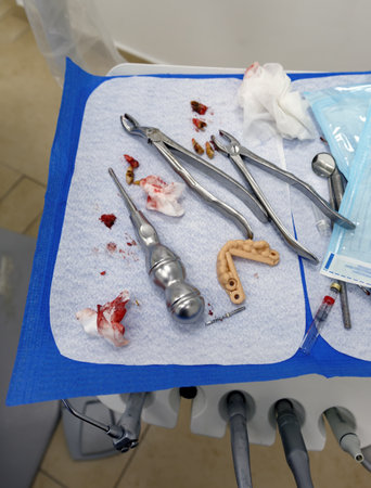 Dentist desk with instruments and teeth in stomatology clinic. Dental tools in table, macro stainless hook, explorer, mouth mirror, forcep, teeth model and mirror tools for cure toothache concept.の写真素材