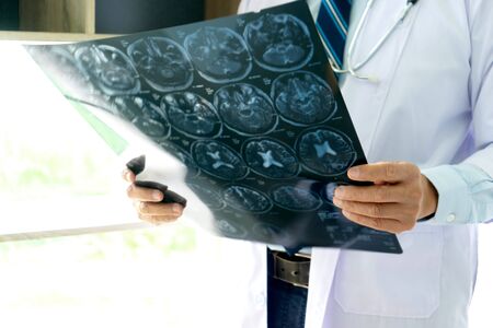 Doctor hold brain X-ray scan film, looking and learn for help the patientの写真素材