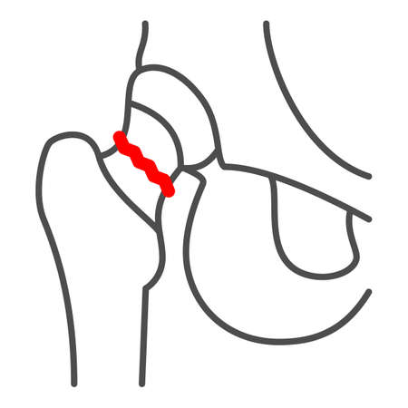 Fracture of femoral neck thin line icon, Human diseases concept, human skeleton fragment sign on white background, Femoral neck fracture icon in outline style for mobile and web. Vector graphics.のイラスト素材