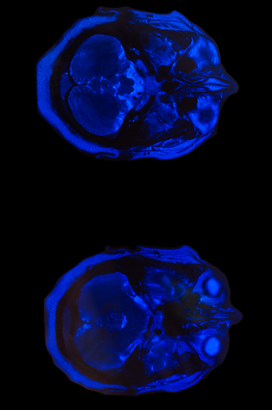 X-ray image of the brain computed tomography, imaging of the brain
