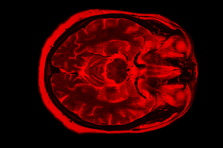 X-ray image of the brain computed tomographyの写真素材