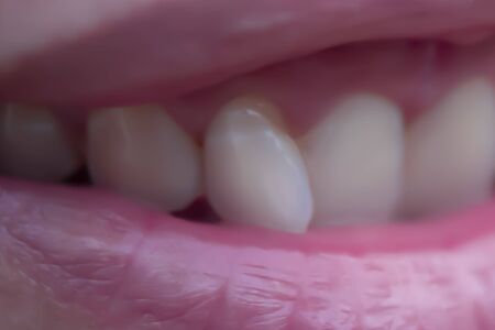 Clean white teeth can indicate the health of the owner of the teeth, how healthy it is.の写真素材