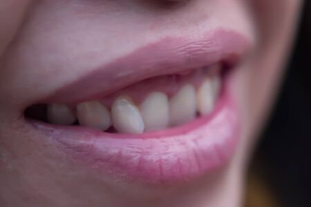 Clean white teeth can indicate the health of the owner of the teeth, how healthy it is.の写真素材