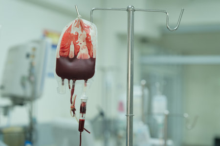 The patient is receiving blood components to replace lost blood to prevent hypovolemic shock.の写真素材