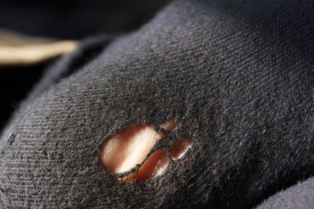 Blue Torn Socks. Man with worn socks.