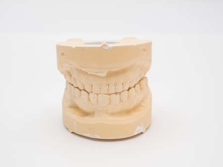 Plaster model or cast of human teeth. Teeth model on a white background.の写真素材