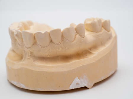 Plaster model or cast of human teeth. Teeth model on a white background.の写真素材