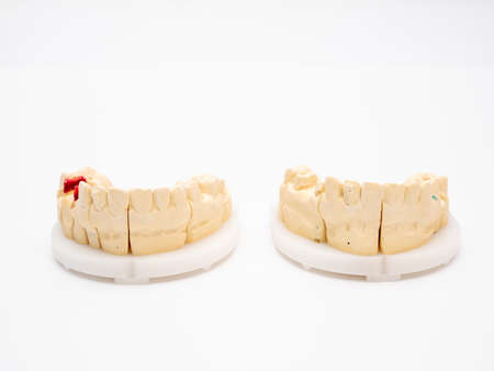 Plaster model or cast of human teeth. Teeth model on a white background.の写真素材