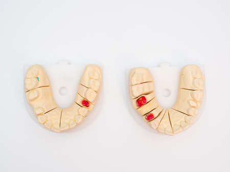 Plaster model or cast of human teeth. Teeth model on a white background.