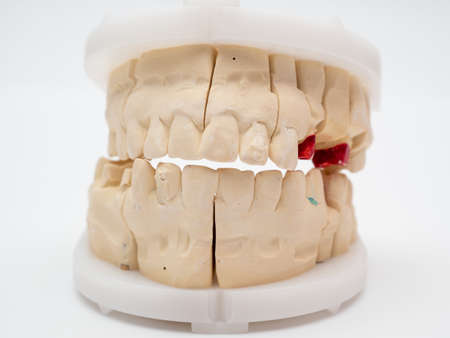 Plaster model or cast of human teeth. Teeth model on a white background.