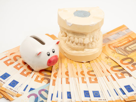 Dental casts, piggy bank and banknotes on a white background. Plaster model of teeth. Close up.の写真素材
