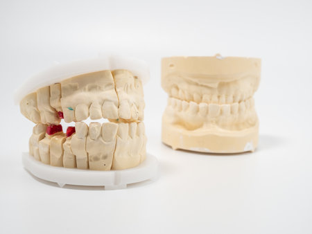 Dental casts on a white background. Plaster model of teeth. Close up.