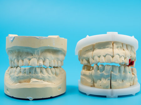 Dental casts on a blue background. Plaster model of teeth. Close up.の写真素材