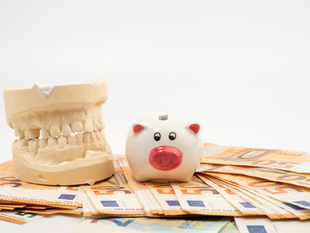 Dental casts, piggy bank and banknotes on a white background. Plaster model of teeth. Close up.の写真素材